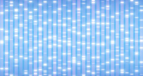 Do We See the Full Microbial Nucleic Acid Picture Without Optimized Sample Prep?